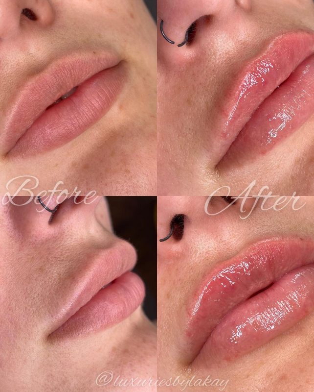 Luxuries By Lakay – Dallas  Body Contouring