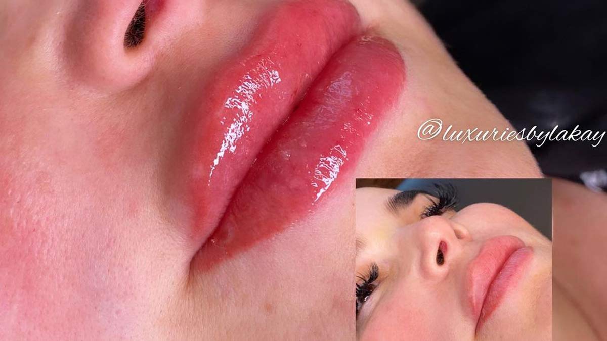 Luxuries By Lakay – Dallas  Body Contouring