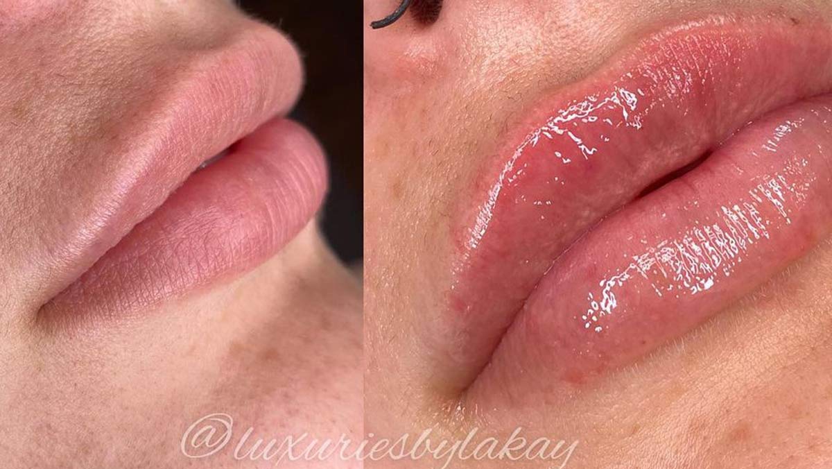 Luxuries By Lakay – Dallas  Body Contouring